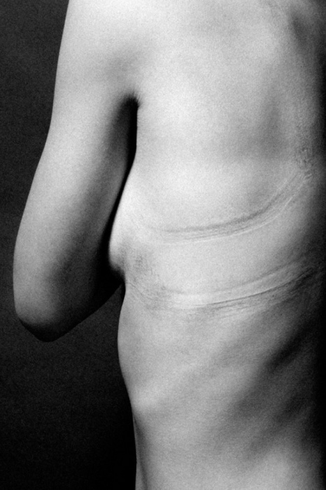 Следы от утягивающего белья.  Автор фото: Джастин Бартелс (Justin Bartels).
