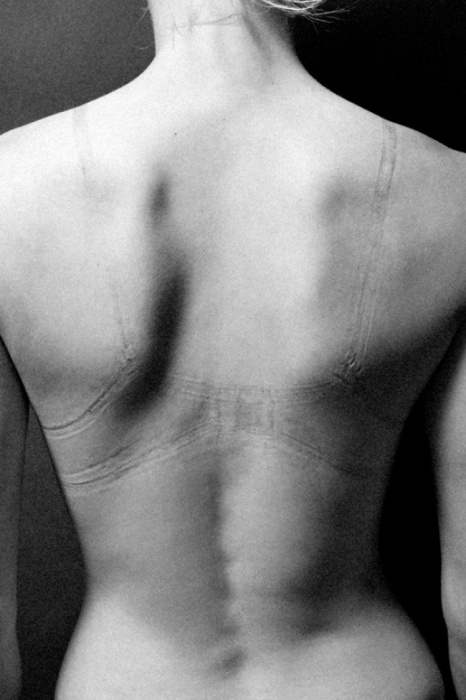 Многие женщины, ради того, чтобы выглядеть идеально, идут на страшные жертвы. Следы от корсета.  Автор фото: Джастин Бартелс (Justin Bartels).