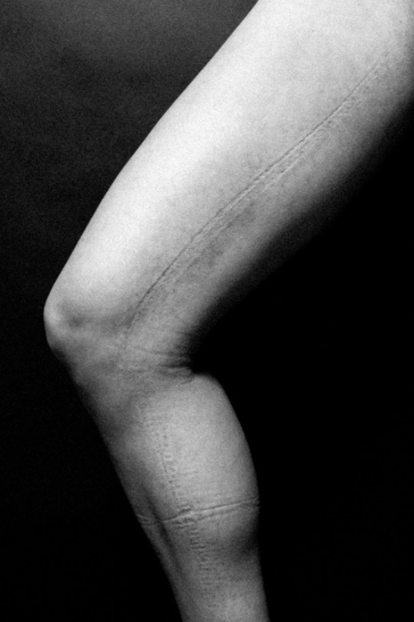 Следы от узких джинсов.  Автор фото: Джастин Бартелс (Justin Bartels).