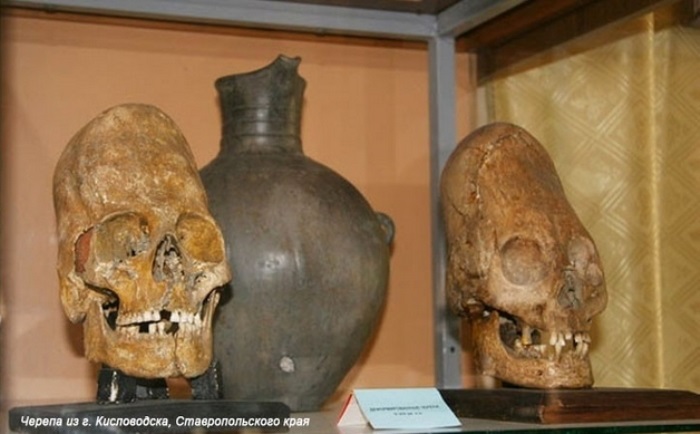 Деформированные черепа, найденные в Ставропольском крае