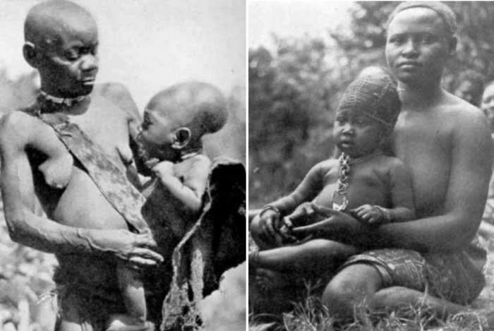 Деформированные черепа представителей африканских племен