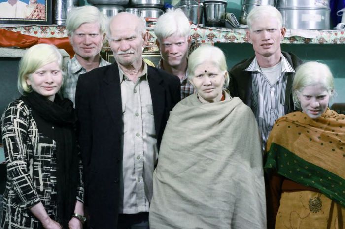 Самая большая семья альбиносов.
