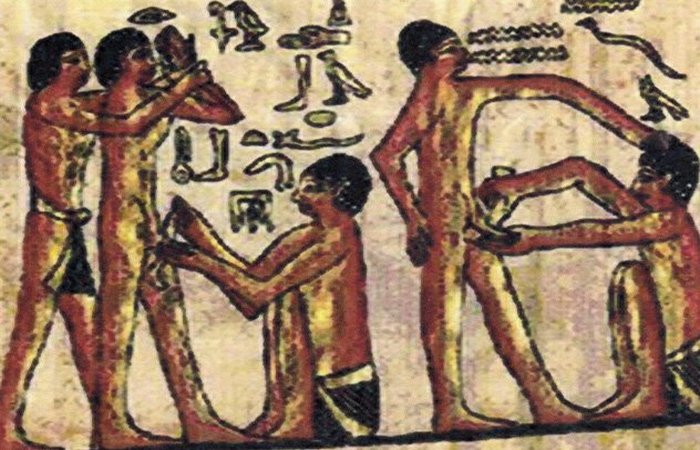 Обрізання в Стародавньому Єгипті.  / Фото: listverse.com